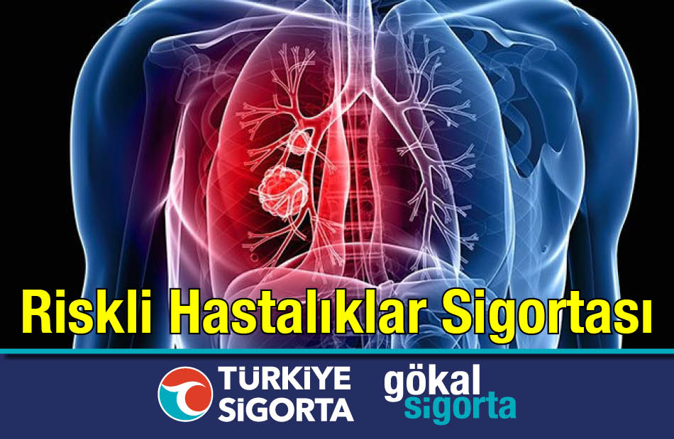 Türkiye Sigorta Genişletilmiş Riskli Hastalıklar Sigortası