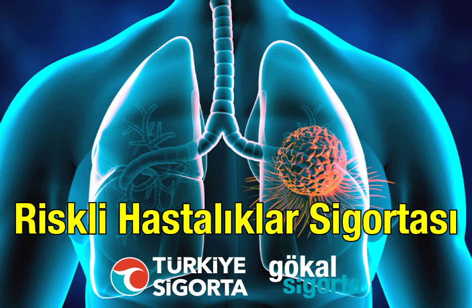 Türkiye Sigorta Genişletilmiş Riskli Hastalıklar Sigortası