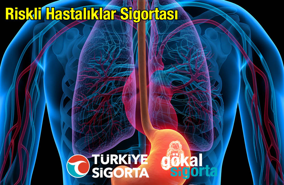 Gökal Sigorta Genişletilmiş Riskli Hastalıklar Sigortası